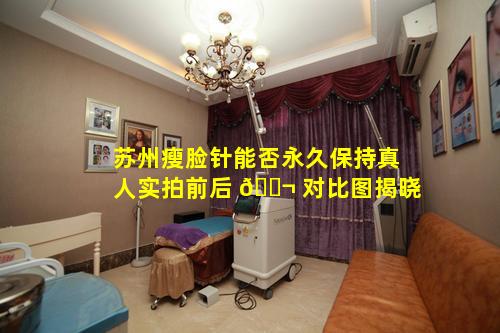 苏州瘦脸针能否永久保持真人实拍前后 🐬 对比图揭晓